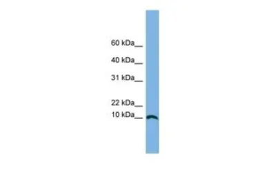 Anti-STRA13 antibody, Internal used in Western Blot (WB). GTX45701