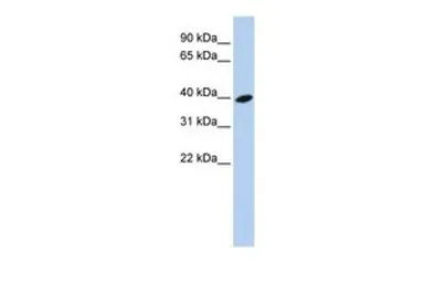 Anti-ARL13B antibody, Internal used in Western Blot (WB). GTX45702