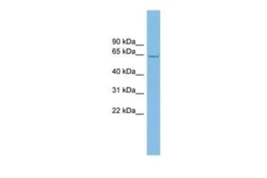 Anti-CRY2 antibody, N-term used in Western Blot (WB). GTX45786