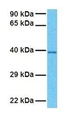 Anti-TXNIP antibody, C-term used in Western Blot (WB). GTX45803
