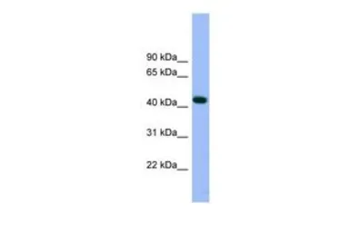 Anti-Arp3 antibody, N-term used in Western Blot (WB). GTX45806