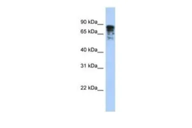 Anti-CRMP4 antibody, Internal used in Western Blot (WB). GTX45814
