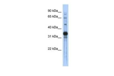 Anti-CHAD antibody, Internal used in Western Blot (WB). GTX45819