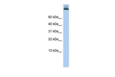 Anti-COPA antibody, Internal used in Western Blot (WB). GTX45827
