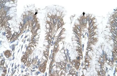 Anti-RSRC2 antibody, C-term used in IHC (Paraffin sections) (IHC-P). GTX45867