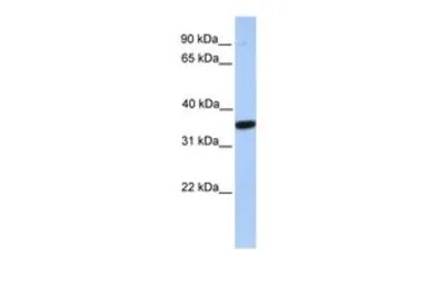 Anti-MOGAT1 antibody, C-term used in Western Blot (WB). GTX45890