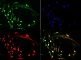 Anti-NFAT2 antibody used in Immunocytochemistry/ Immunofluorescence (ICC/IF). GTX45916
