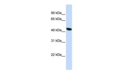 Anti-TMEM117 antibody, Internal used in Western Blot (WB). GTX45929
