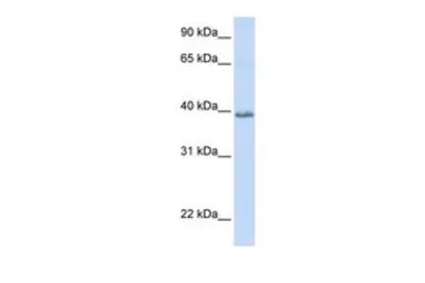 Anti-TSPAN10 antibody, N-term used in Western Blot (WB). GTX45936