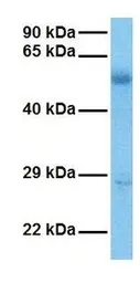 Anti-LPCAT1 antibody, Internal used in Western Blot (WB). GTX45969