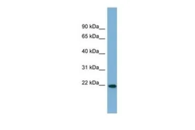 Anti-FNDC4 antibody, Internal used in Western Blot (WB). GTX46001