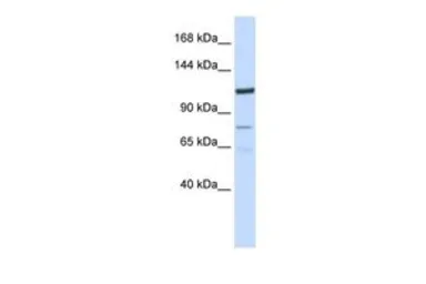 Anti-EIG121 antibody, N-term used in Western Blot (WB). GTX46044