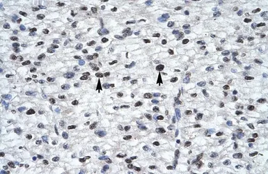 Anti-Gli2 antibody, Internal used in IHC (Paraffin sections) (IHC-P). GTX46056