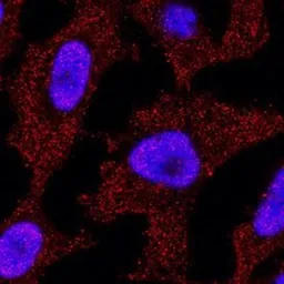 Anti-p73 antibody [5B429] used in Immunocytochemistry/ Immunofluorescence (ICC/IF). GTX46123