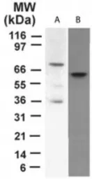Anti-p73 antibody [5B429] used in Western Blot (WB). GTX46123