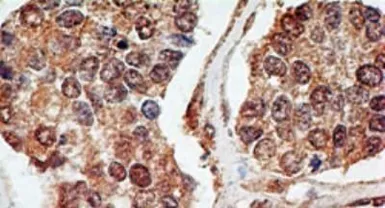 Anti-p73 antibody [5B429] used in IHC (Paraffin sections) (IHC-P). GTX46123