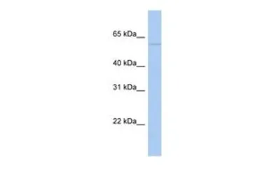 Anti-PAPD4 antibody, N-term used in Western Blot (WB). GTX46128