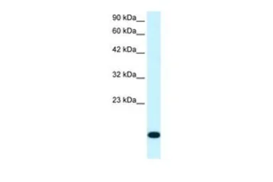 Anti-RPS16 antibody, N-term used in Western Blot (WB). GTX46159