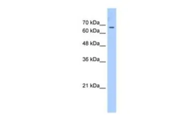 Anti-CDY1 antibody, C-term used in Western Blot (WB). GTX46209