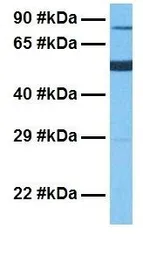 Anti-NEXN antibody, Internal used in Western Blot (WB). GTX46266