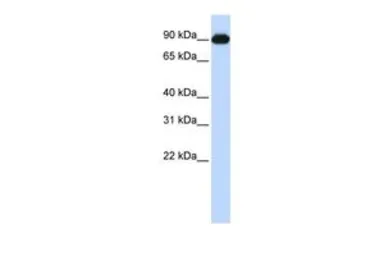 Anti-CTAGE5 antibody, Internal used in Western Blot (WB). GTX46273