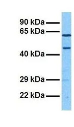 Anti-NPNT antibody, Internal used in Western Blot (WB). GTX46290