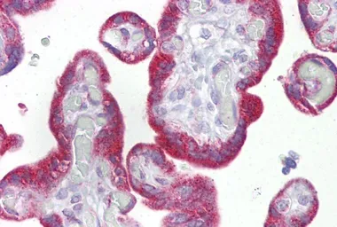 Anti-Cytokeratin 23 antibody, Internal used in IHC (Paraffin sections) (IHC-P). GTX46291