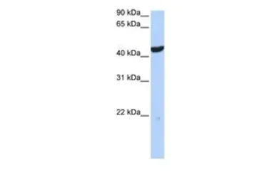 Anti-Cytokeratin 23 antibody, Internal used in Western Blot (WB). GTX46291