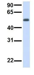 Anti-TMEM57 antibody, N-term used in Western Blot (WB). GTX46302