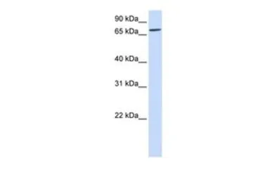 Anti-IL1RAPL2 antibody, Internal used in Western Blot (WB). GTX46331
