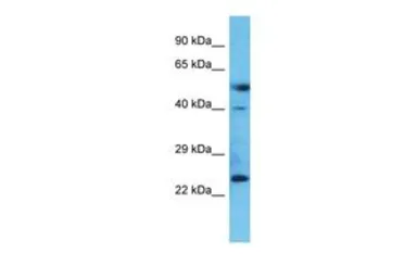 Anti-C20ORF103 antibody, Internal used in Western Blot (WB). GTX46392