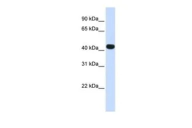 Anti-HS3ST3B1 antibody, N-term used in Western Blot (WB). GTX46416