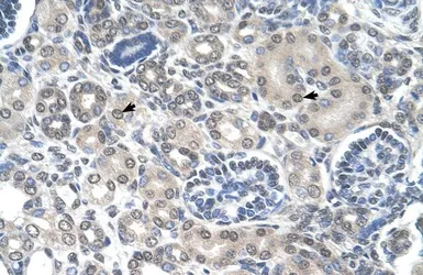 Anti-PPAT antibody, N-term used in IHC (Paraffin sections) (IHC-P). GTX46492