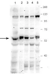 Anti-PPAT antibody, N-term used in Western Blot (WB). GTX46492