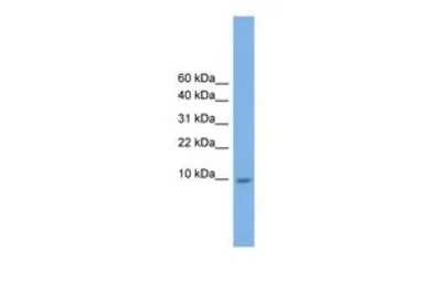 Anti-KRTAP23-1 antibody, Internal used in Western Blot (WB). GTX46504