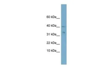 Anti-NDUFV3 antibody, Internal used in Western Blot (WB). GTX46530
