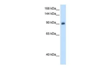 Anti-Mineralocorticoid Receptor antibody, Internal used in Western Blot (WB). GTX46537