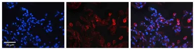Anti-DEGS1 antibody, N-term used in IHC (Paraffin sections) (IHC-P). GTX46544