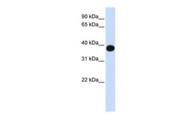 Anti-DEGS1 antibody, N-term used in Western Blot (WB). GTX46544