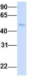Anti-CHST1 antibody, Internal used in Western Blot (WB). GTX46545
