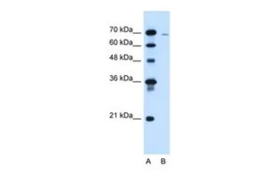 Anti-CLCC1 antibody, N-term used in Western Blot (WB). GTX46587
