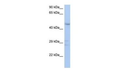 Anti-ACPL2 antibody, Internal used in Western Blot (WB). GTX46615
