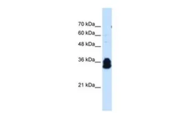 Anti-FAM134B antibody, Internal used in Western Blot (WB). GTX46621