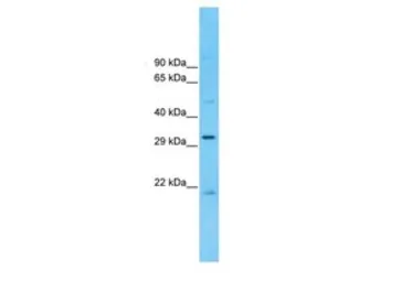 Anti-CCDC90A antibody, Internal used in Western Blot (WB). GTX46635