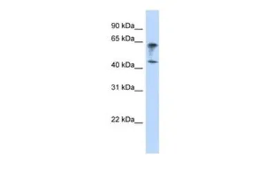 Anti-IGSF11 antibody, Internal used in Western Blot (WB). GTX46653