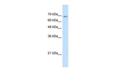 Anti-TM9SF1 antibody, N-term used in Western Blot (WB). GTX46659