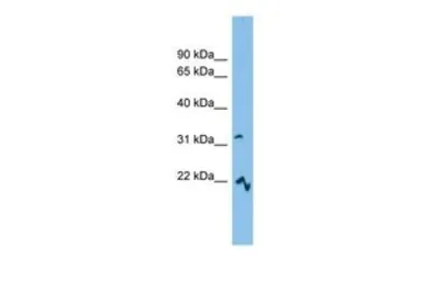 Anti-MCART6 antibody, Internal used in Western Blot (WB). GTX46670