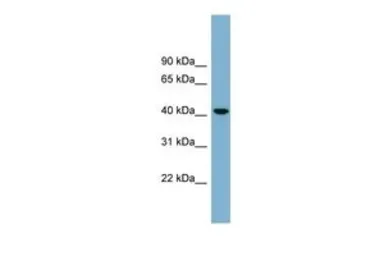 Anti-B4GALT2 antibody, Internal used in Western Blot (WB). GTX46703
