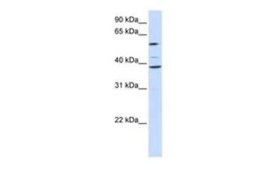 Anti-SLC25A16 antibody, Internal used in Western Blot (WB). GTX46765
