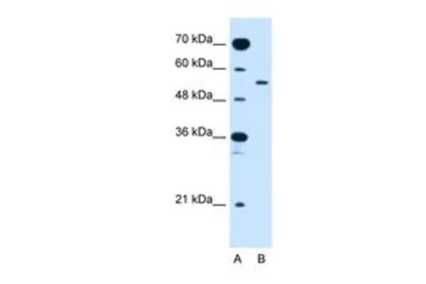Anti-GLUT10 antibody, Internal used in Western Blot (WB). GTX46790